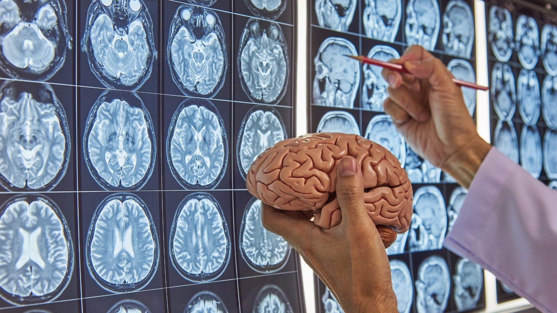 Una aplicación diseñada en la UGR ayuda al estudio del cerebro gracias a la  inteligencia artificial - Canal UGR